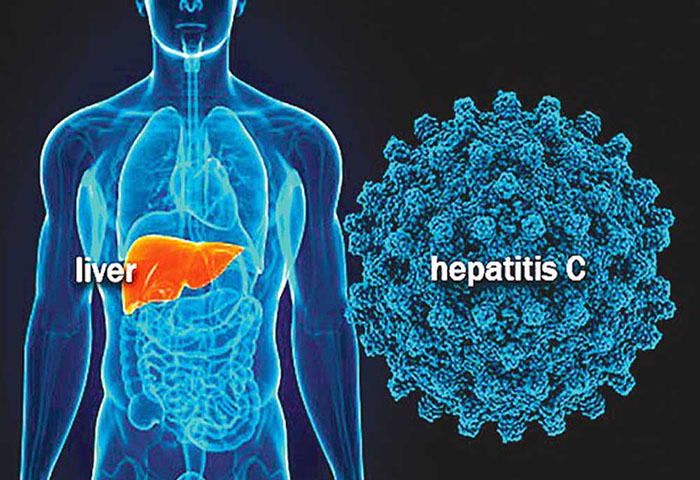 hepatitis-C